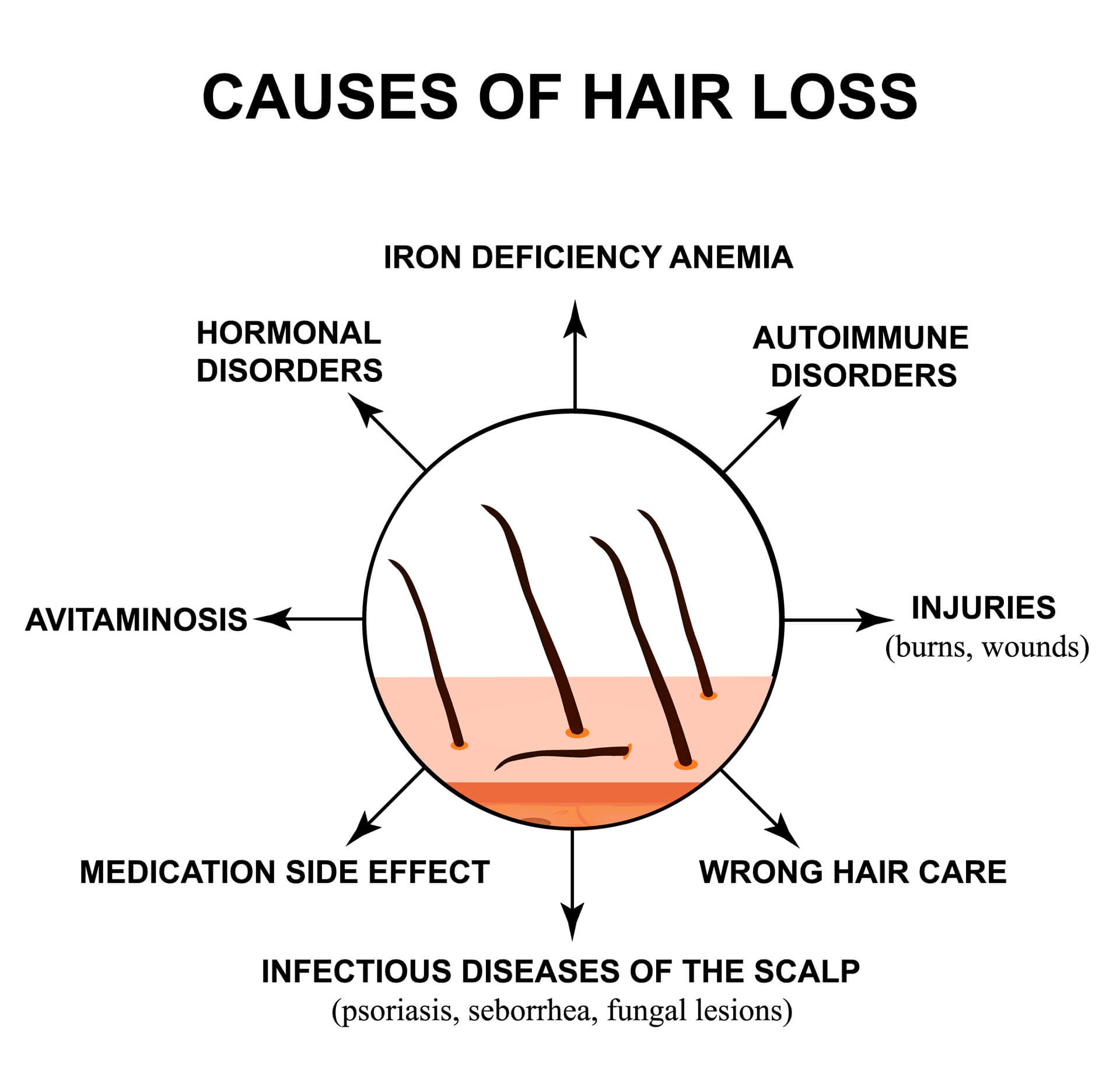 //millenniumhairclinic.ie/wp-content/uploads/2020/05/Millennium-less-common-hair-disorders.jpg
